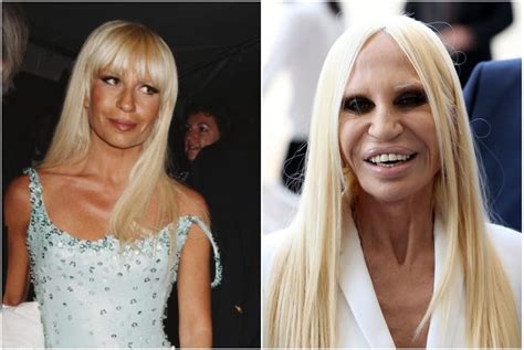 donatella versace weight loss